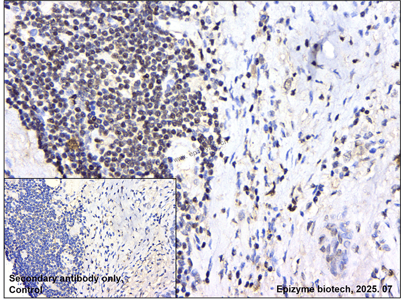 Anti-ETS2 Rabbit mAb [11P95B00]