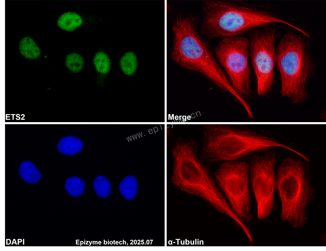 Anti-ETS2 Rabbit mAb [11P95B00]