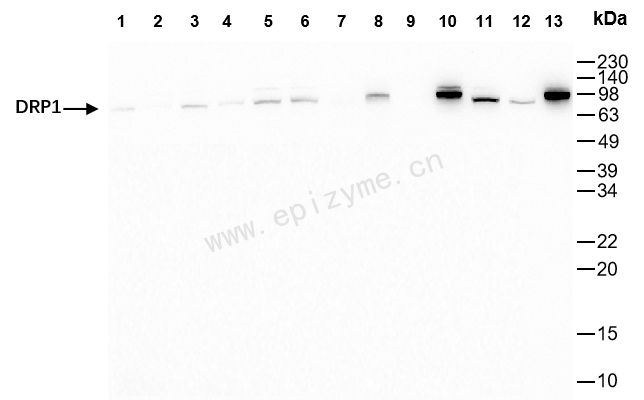 Anti-DRP1 Rabbit mAb [36G02G45]