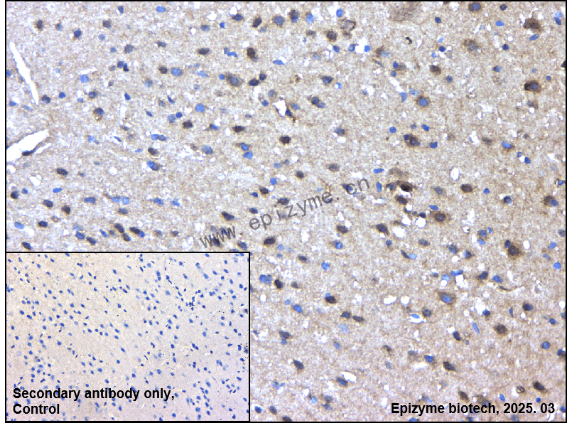 Anti-DRP1 Rabbit mAb [36G02G45]