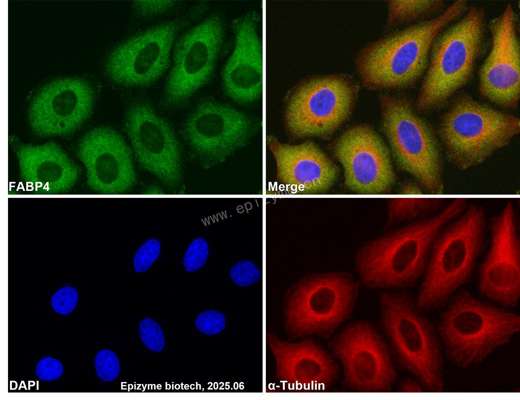 Anti-FABP4 Rabbit mAb [35Q49K98]