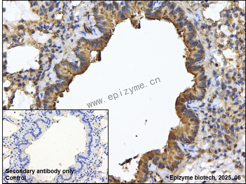 Anti-FABP4 Rabbit mAb [35Q49K98]
