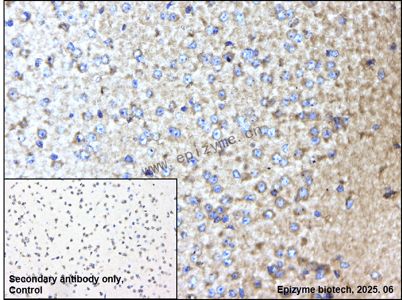 Anti-FABP4 Rabbit mAb [35Q49K98]