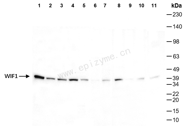 Anti-WIF1 Rabbit mAb [14N40E55]