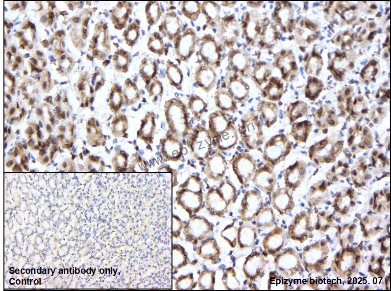 Anti-PTPN1/2 Rabbit mAb [91M66B51]