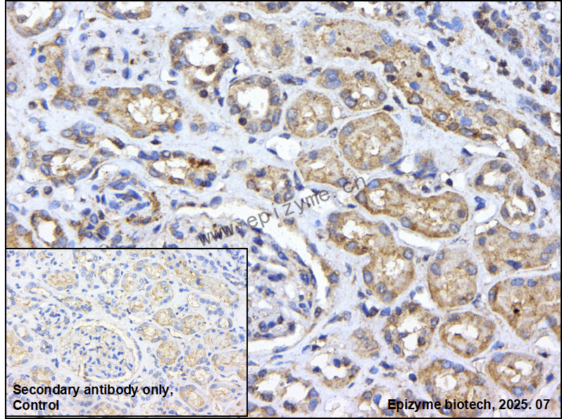 Anti-PTPN1/2 Rabbit mAb [91M66B51]