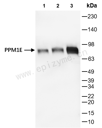 Anti-PPM1E Rabbit mAb [15N15F69]
