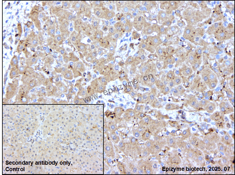 Anti-PPM1E Rabbit mAb [15N15F69]