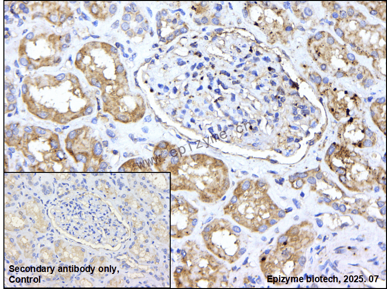 Anti-PPM1E Rabbit mAb [15N15F69]