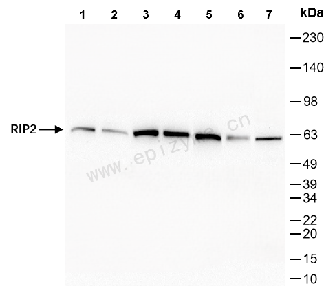 Anti-RIP2 Rabbit mAb [43D29Q03]