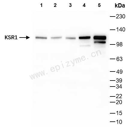 Anti-KSR1 Rabbit mAb [24N34J95]