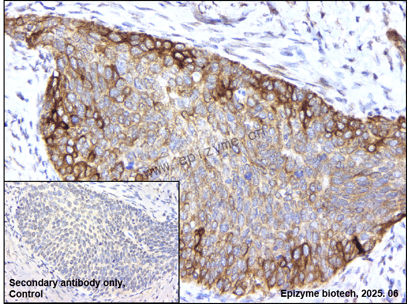 Anti-KSR1 Rabbit mAb [24N34J95]