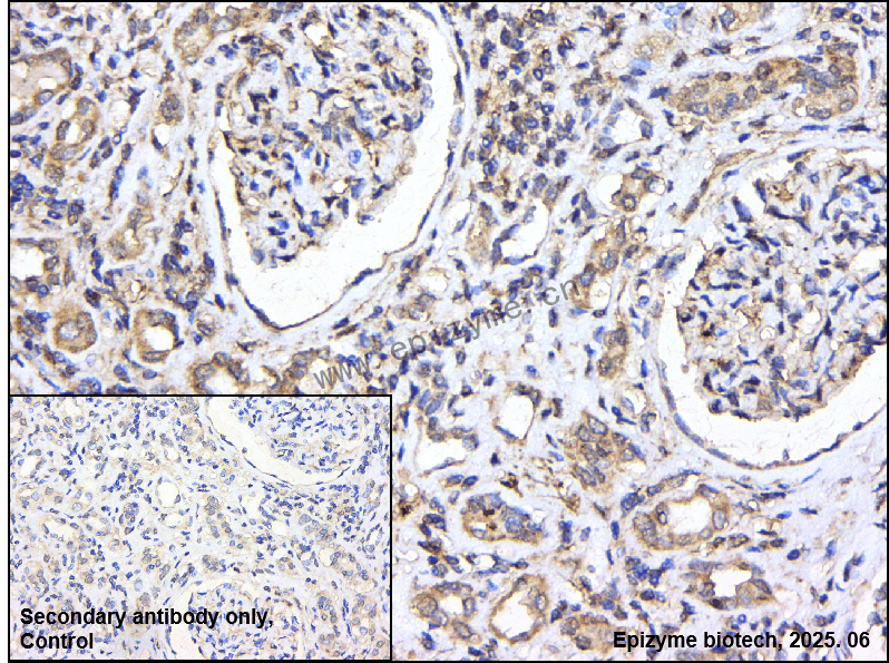 Anti-KSR1 Rabbit mAb [24N34J95]