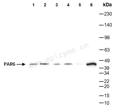 Anti-PAR6 Rabbit mAb [94I34J17]