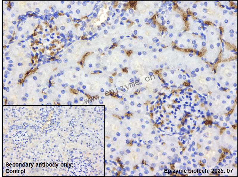 Anti-Hemoglobin alpha Rabbit mAb [82N65L51]