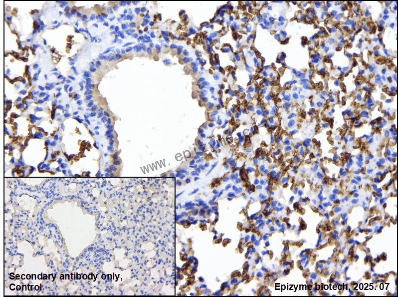 Anti-Hemoglobin alpha Rabbit mAb [82N65L51]