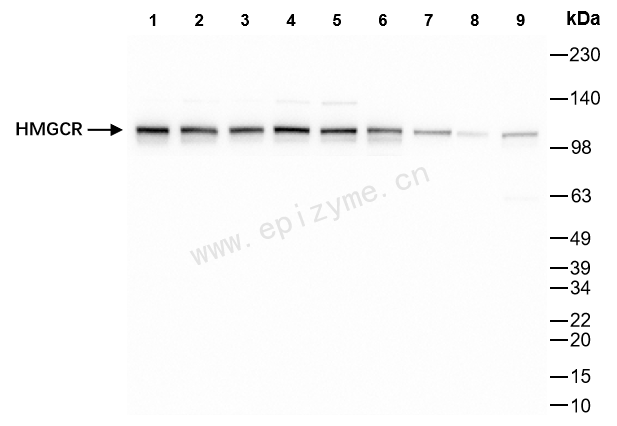 Anti-HMGCR Rabbit mAb [36M87K05]