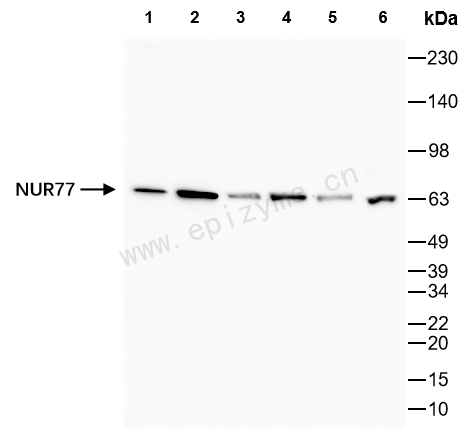 Anti-NUR77 Rabbit mAb [48L99D54]