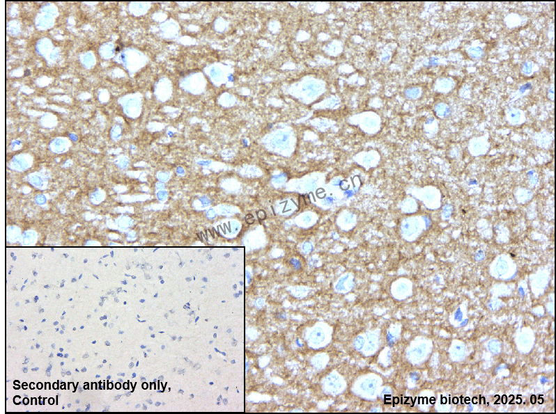 Anti-CNTNAP2 Rabbit mAb [50C80K29]