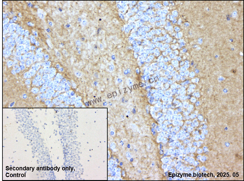 Anti-CNTNAP2 Rabbit mAb [50C80K29]