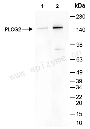 Anti-PLCG2 Rabbit mAb [51B24H91]