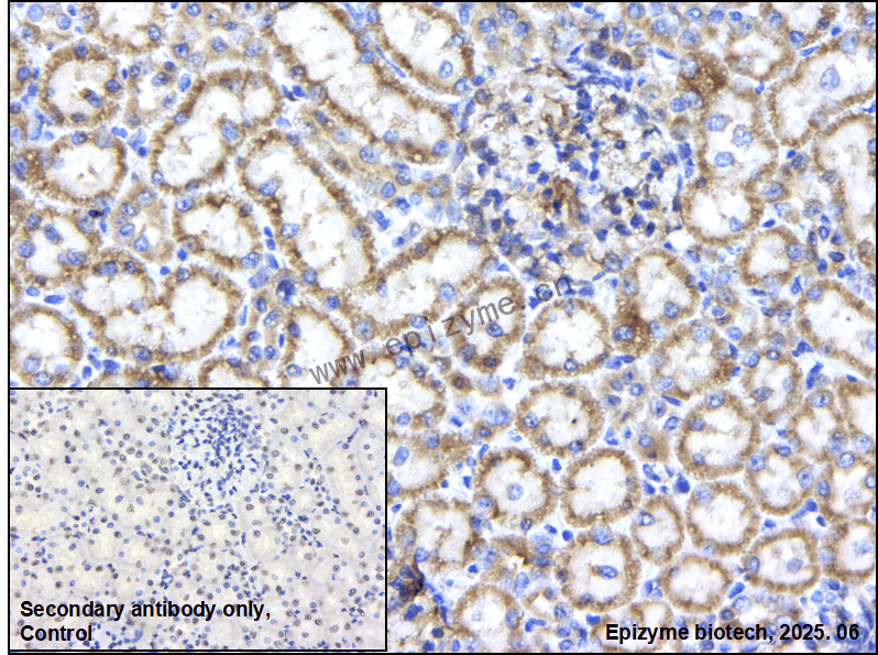 Anti-PLCG2 Rabbit mAb [51B24H91]