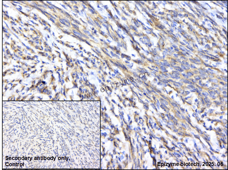 Anti-PLCG2 Rabbit mAb [51B24H91]