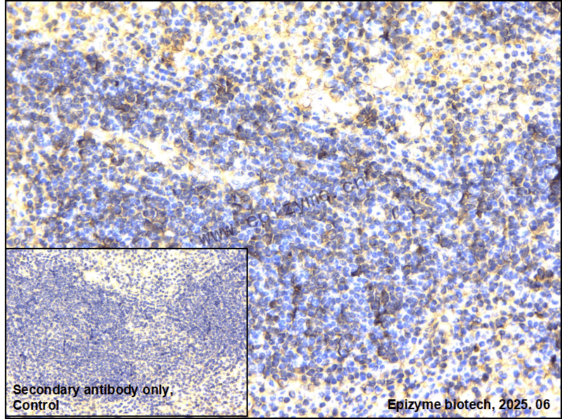 Anti-PLCG2 Rabbit mAb [51B24H91]