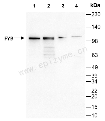 Anti-FYB Rabbit mAb [56L30C92]