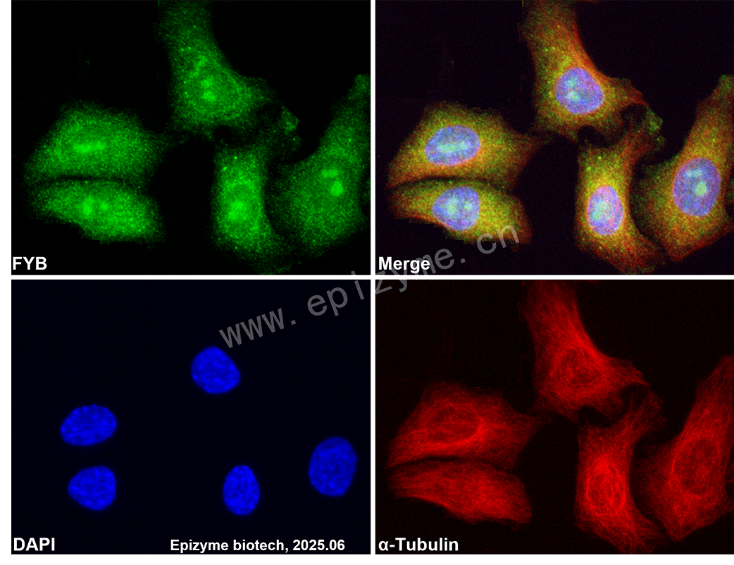 Anti-FYB Rabbit mAb [56L30C92]