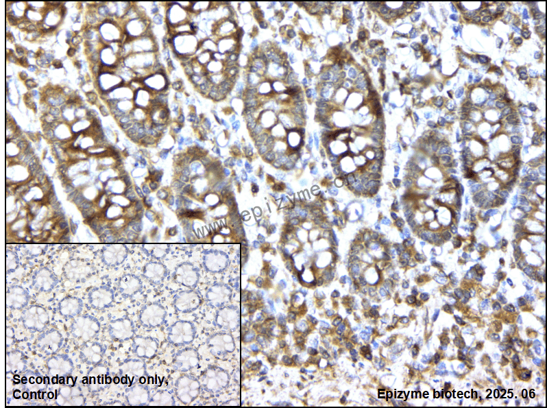 Anti-FYB Rabbit mAb [56L30C92]