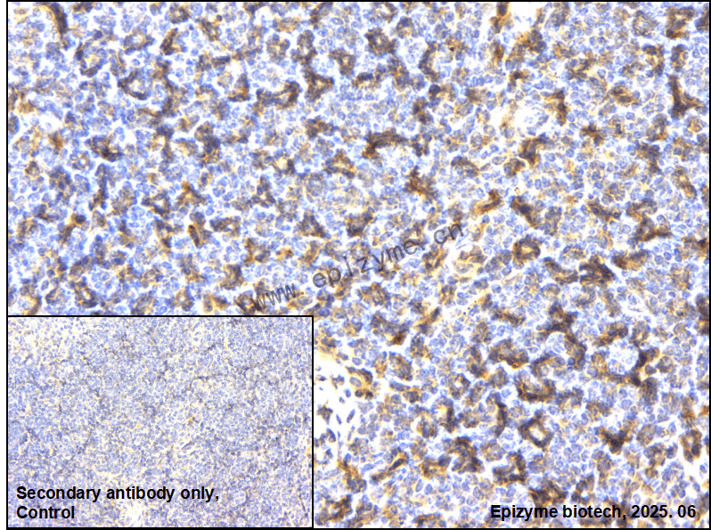 Anti-FYB Rabbit mAb [56L30C92]