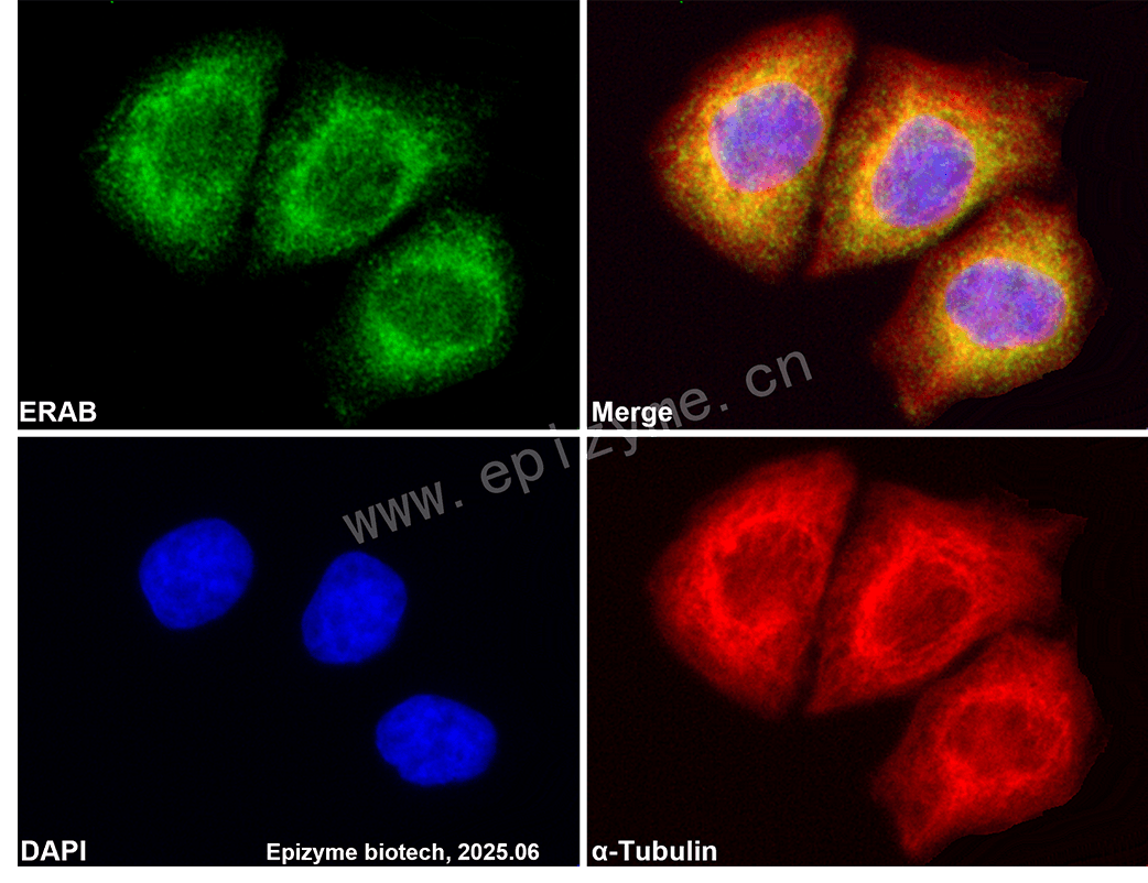 Anti-ERAB Rabbit mAb [36N17A92]