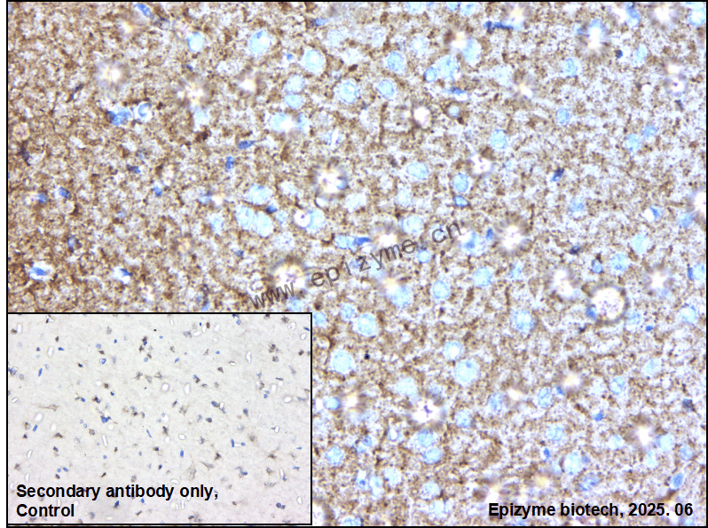 Anti-ERAB Rabbit mAb [36N17A92]