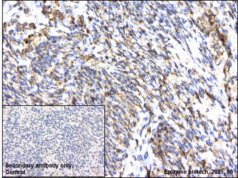Anti-ERAB Rabbit mAb [36N17A92]