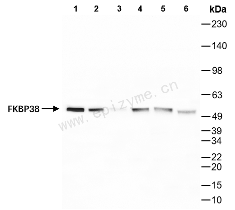 Anti-FKBP38 Rabbit mAb [17S92M95]