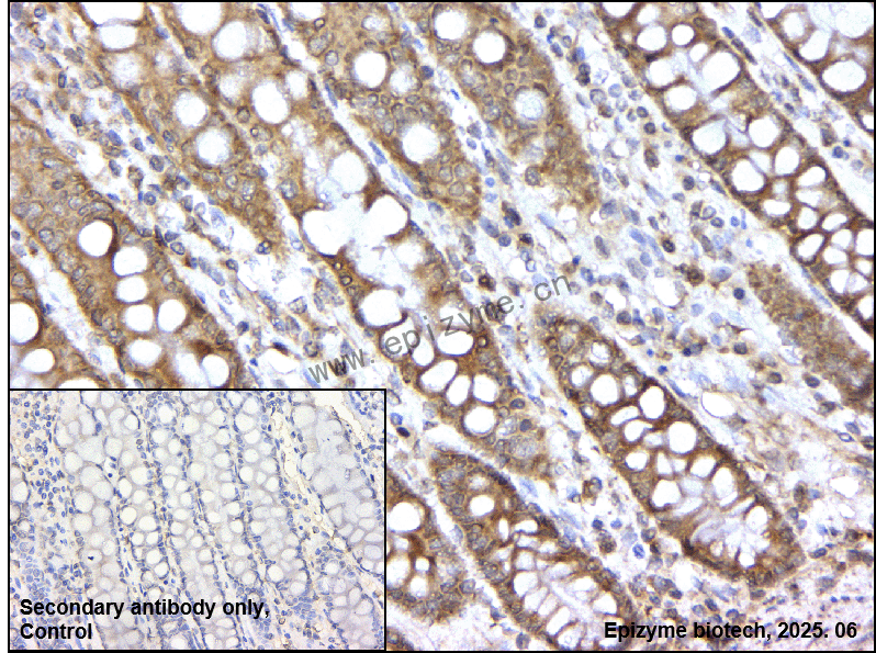 Anti-FKBP38 Rabbit mAb [17S92M95]