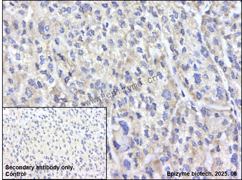 Anti-FKBP38 Rabbit mAb [17S92M95]