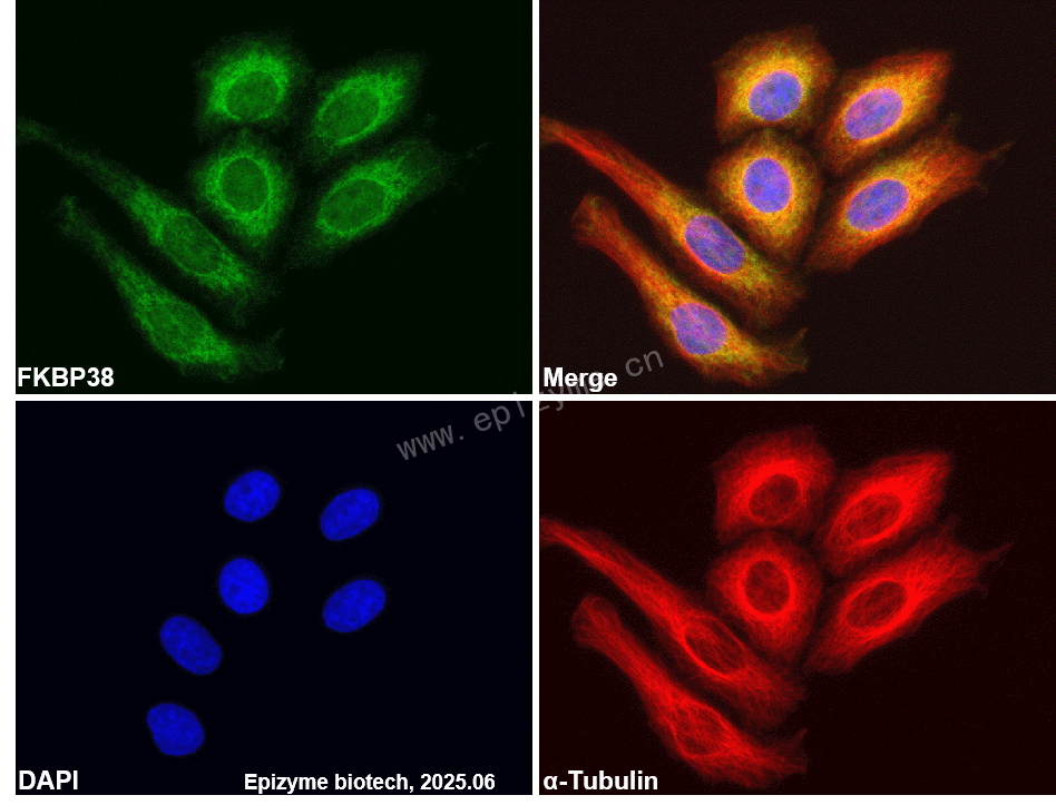 Anti-FKBP38 Rabbit mAb [17S92M95]