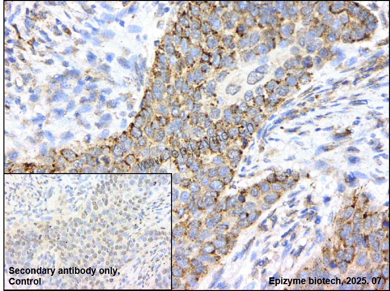 Anti-ROS1 Rabbit mAb [98D10D73]