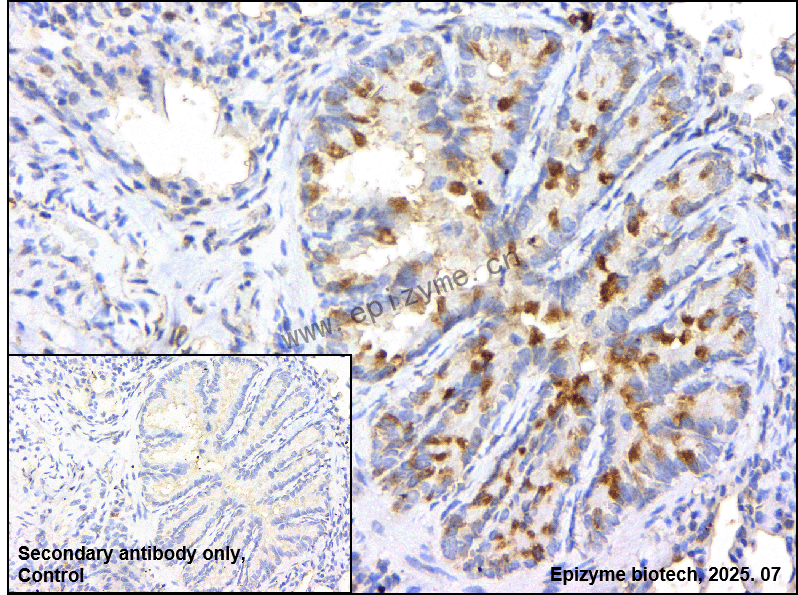 Anti-ROS1 Rabbit mAb [98D10D73]