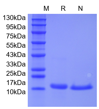 Recombinant Human IL-21
