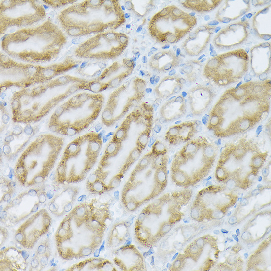 Anti-PIK3CA Rabbit pAb