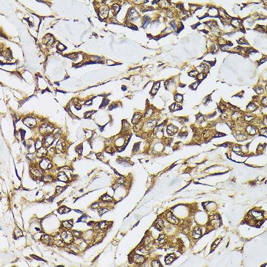 Anti-PIK3CA Rabbit pAb
