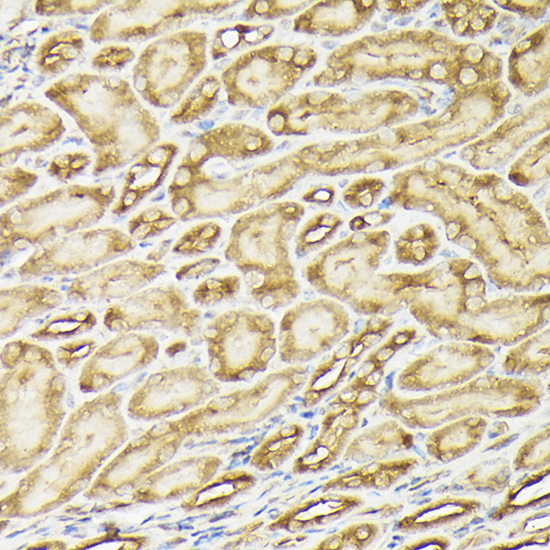 Anti-PIK3CA Rabbit pAb
