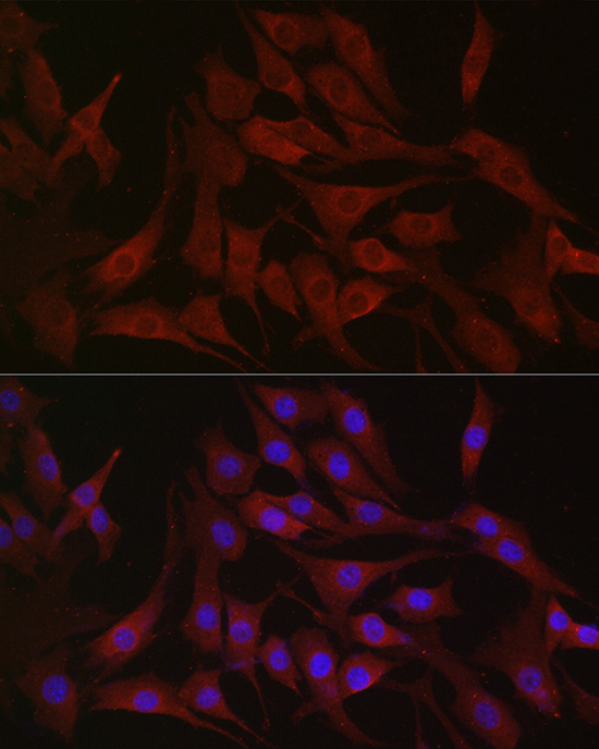 Anti-PIK3CA Rabbit pAb
