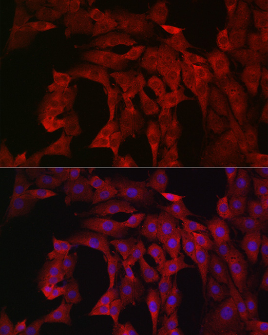 Anti-PIK3CA Rabbit pAb