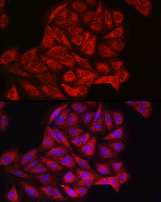 Anti-PIK3CA Rabbit pAb