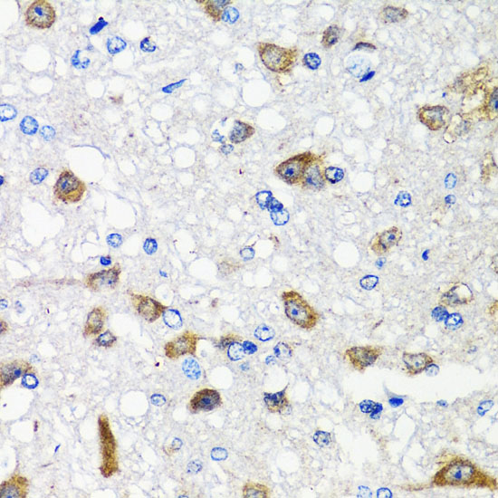 Anti-ACVR1C Rabbit pAb
