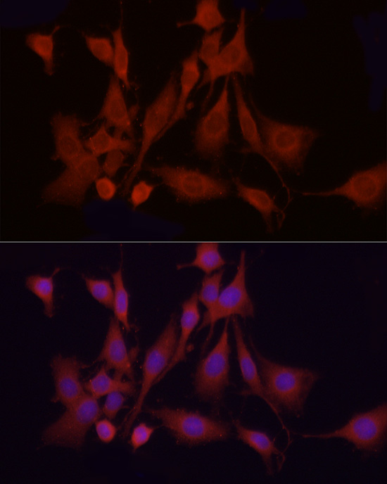 Anti-APAF1 Rabbit pAb